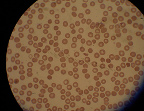 muestra de glóbulos rojos